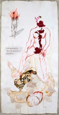 Beheaded After Prostate Surgery