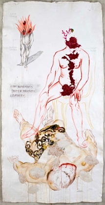 Beheaded After Prostate Surgery