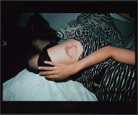 Heart-Shaped Bruise, NYC (1980)