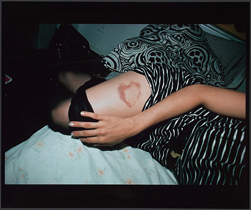 Heart-Shaped Bruise, NYC (1980)