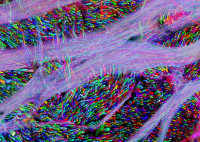 "Brainbow" mouse brain stem with auditory pathway axons (40x), by Dr. Jean Livet (2008)