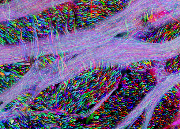 "Brainbow" mouse brain stem with auditory pathway axons (40x), by Dr. Jean Livet (2008)