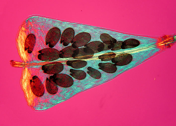 Embryo seeds of Capsella bursa-pastoris within fruit capsule (25x), by Aaron Messing (2002)