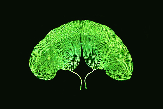 House cricket's tongue "Acheta domesticus" (25x), by Stefano Barone (2014)